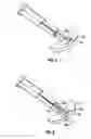 Fig. 05 - Method and apparatus for meniscal repair