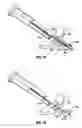 Fig. 08 - Method and apparatus for meniscal repair