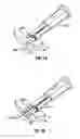 Fig. 12 - Method and apparatus for meniscal repair