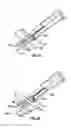 Fig. 13 - Method and apparatus for meniscal repair