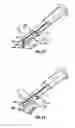 Fig. 14 - Method and apparatus for meniscal repair