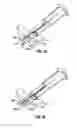 Fig. 15 - Method and apparatus for meniscal repair