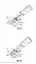 Fig. 16 - Method and apparatus for meniscal repair