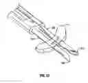 Fig. 24 - Method and apparatus for meniscal repair