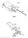 Fig. 50 - Method and apparatus for meniscal repair