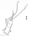 Fig. 57 - Method and apparatus for meniscal repair