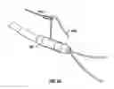 Fig. 60 - Method and apparatus for meniscal repair