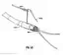 Fig. 61 - Method and apparatus for meniscal repair