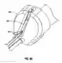 Fig. 69 - Method and apparatus for meniscal repair
