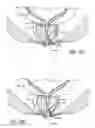 Fig. 10 - Latching anchor device