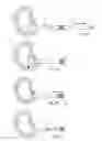 Fig. 08 - System and devices for the repair of a vertebral disc defect