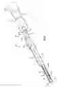 Fig. 08 - Instruments and methods for minimally invasive carpal tunnel release
