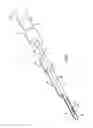 Fig. 09 - Instruments and methods for minimally invasive carpal tunnel release