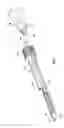 Fig. 22 - Instruments and methods for minimally invasive carpal tunnel release