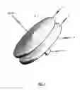 Fig. 02 - Occlusion device and method for its manufacture
