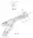 Fig. 40 - Closure device, deployment apparatus, and method of deploying a closure device