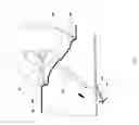 Fig. 87 - Closure device, deployment apparatus, and method of deploying a closure device