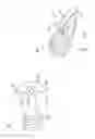 Fig. 02 - Bone fasteners and method for stabilizing vertebral bone facets using the bone fasteners