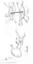 Fig. 16 - Bone fasteners and method for stabilizing vertebral bone facets using the bone fasteners