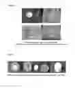 Fig. 06 - 3-dimensional silk hydroxyapatite compositions