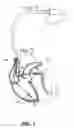 Fig. 02 - Systems and methods to synchronize commands sent to a multi-electrode lead (MEL) with a portion of a cardiac pacing cycle