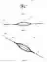Fig. 07 - STENT