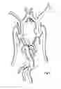 Fig. 02 - Luminal endoprosthesis for the occlusion of an aneurysm and method of manufacturing such an endoprosthesis