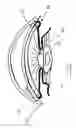 Fig. 03 - Intraocular pressure regulating device