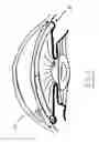 Fig. 04 - Intraocular pressure regulating device