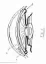 Fig. 05 - Intraocular pressure regulating device