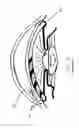 Fig. 06 - Intraocular pressure regulating device
