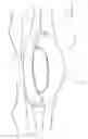 Fig. 11 - Intraocular pressure regulating device
