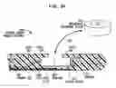 Fig. 09 - IMPLANTABLE MICROPHONE SYSTEM