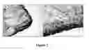Fig. 08 - Structurally modified acellular tissue engineering scaffolds and methods of production