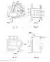 Fig. 02 - Sliding intervertebral implant method