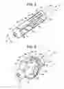 Fig. 05 - Methods and apparatuses for bone restoration