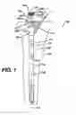 Fig. 02 - Instrument and associated method of trialing for modular hip stems