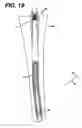 Fig. 19 - Instrument and associated method of trialing for modular hip stems