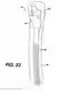 Fig. 23 - Instrument and associated method of trialing for modular hip stems