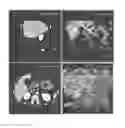 Fig. 02 - METHOD FOR NORMALIZING THE RESULTS OF AN IN-VITRO ANALYTICAL METHOD