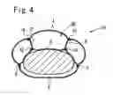 Fig. 04 - Airbag jacket