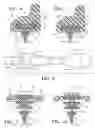 Fig. 05 - Windshield wiper assembly