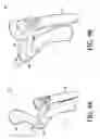 Fig. 05 - Handgrip assembly for a suction attachment