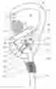 Fig. 01 - Safety device