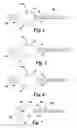 Fig. 03 - PULSE DETONATION COMBUSTOR CONFIGURATION FOR DEFLAGRATION TO DETONATION TRANSITION ENHANCEMENT