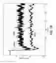 Fig. 85 - Correcting for two-phase flow in a digital flowmeter