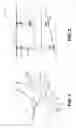 Fig. 02 - Aircraft stabilizer actuator