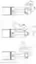 Fig. 22 - Variable compression ratio engine