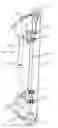 Fig. 01 - Cable buss apparatus for deflecting tension cables in a compound bow