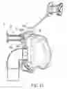 Fig. 13 - Respiratory mask including an adjustment unit